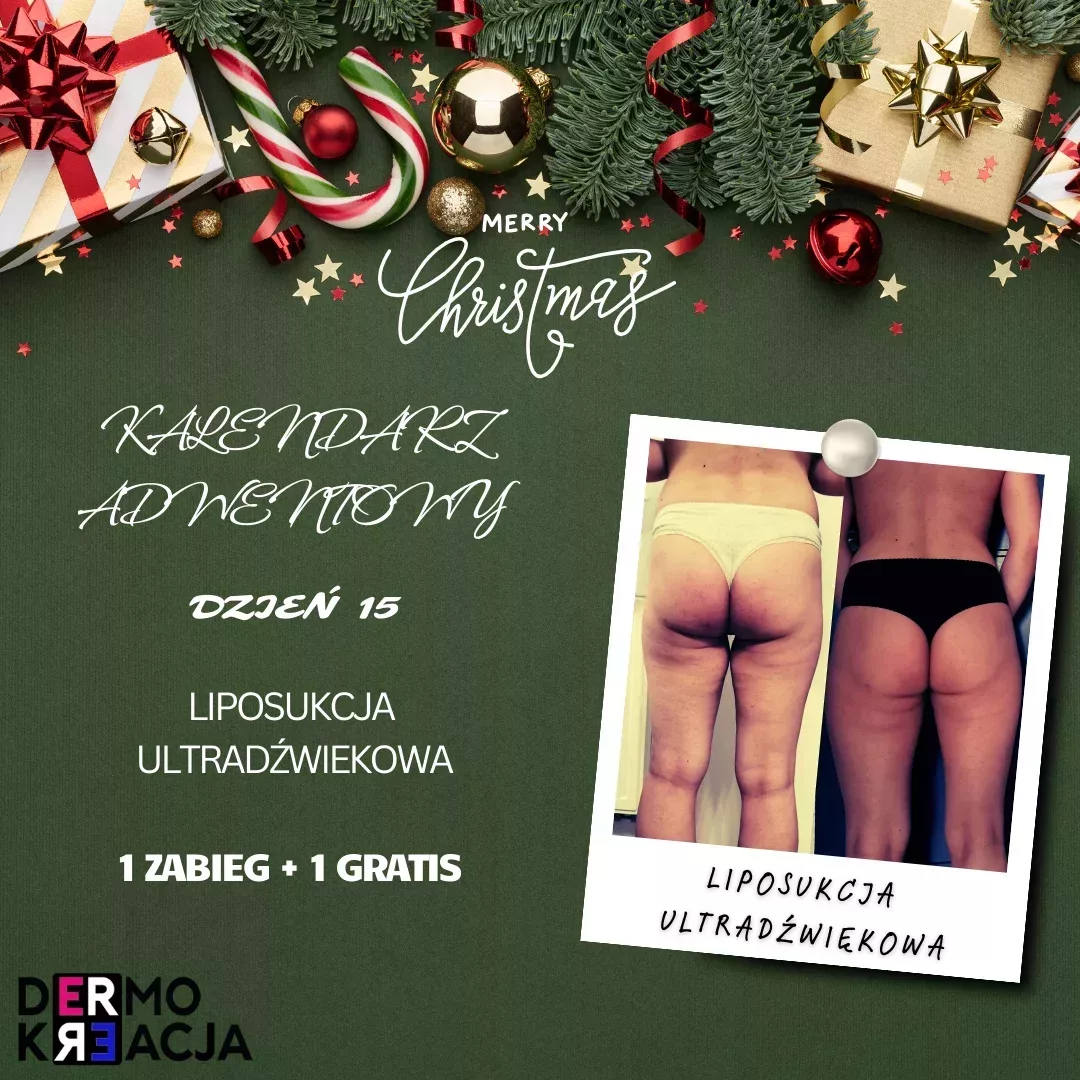 Liposukcja Ultradźwiękowa 1 zabieg + 1 zabieg gratis!